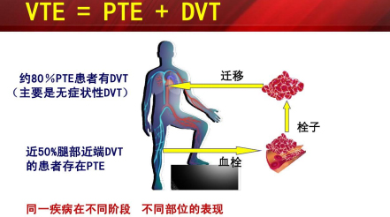什么是臨床上一致公認的VTE防治基礎？