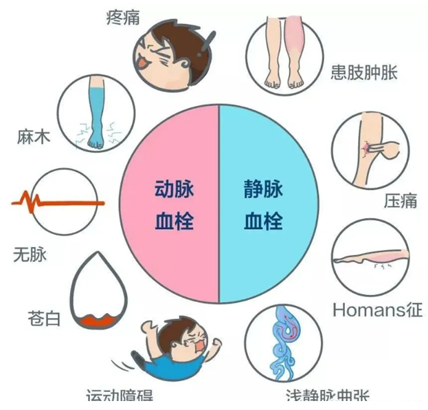 2022世界血栓日：就醫(yī)有新路，血栓找介入