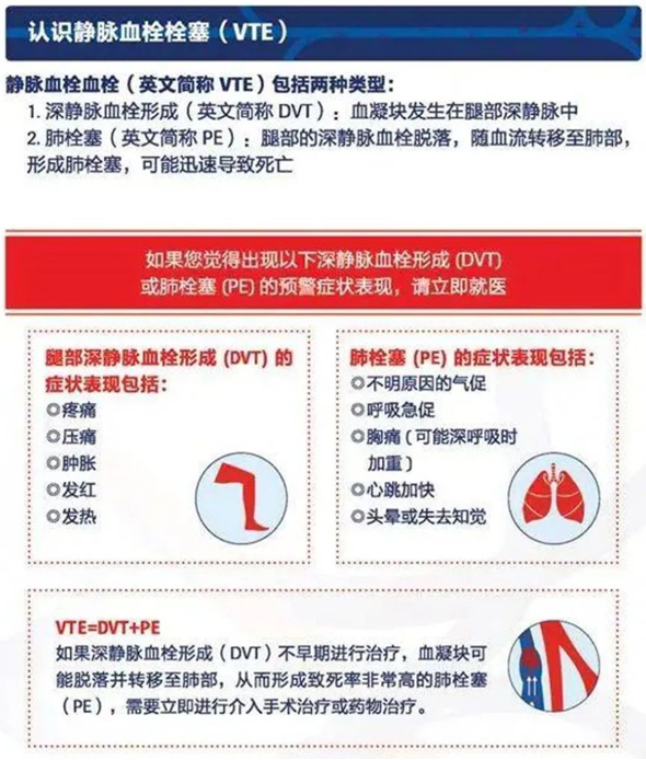 2022世界血栓日：就醫(yī)有新路，血栓找介入
