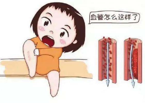 腫瘤不容忽視的第二號(hào)殺手—VTE，該如何防治？