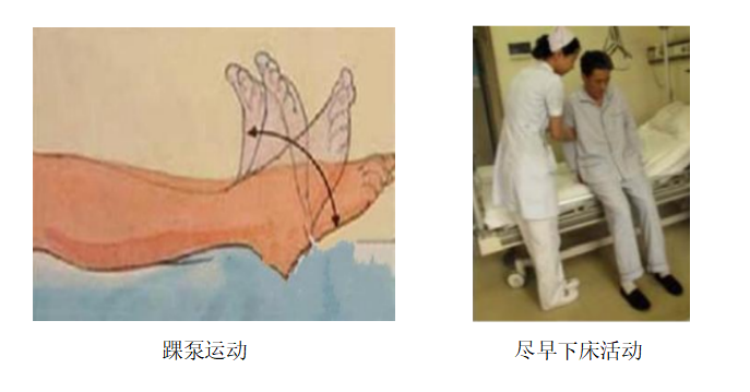 圍術(shù)期患者VTE的預(yù)防，只知道抗凝可不行