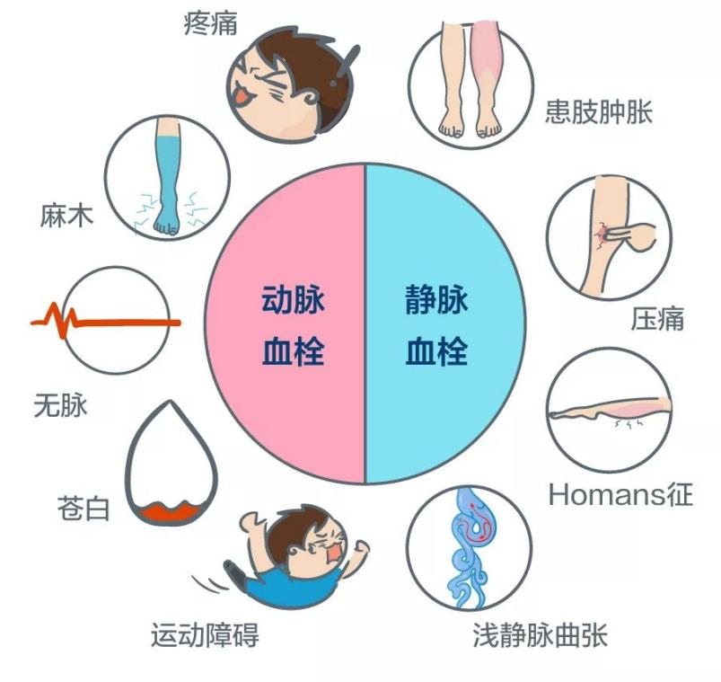 深靜脈血栓能致命，防治“大法”要了解！