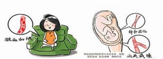 妊娠過(guò)程中的“潛伏殺手”——易栓癥
